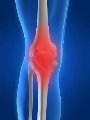 KNEE_PAIN.jpg KNEE_PAIN.jpg