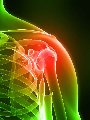 Shoulder_Pain_Relief_90x120.jpg